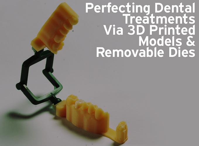 Perfecting Dental Treatments Via 3D Printed Models & Removable Dies