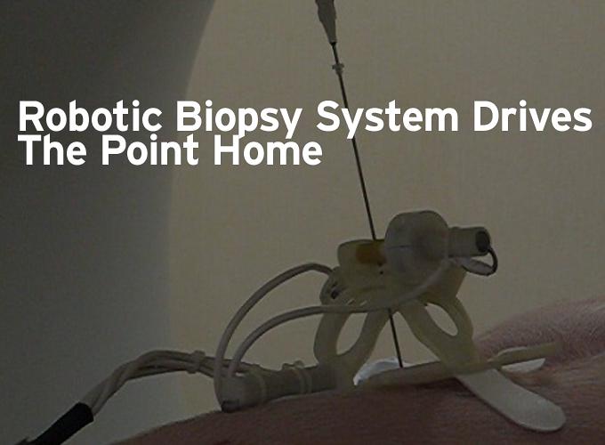 Robotic Biopsy System Drives the Point Home
